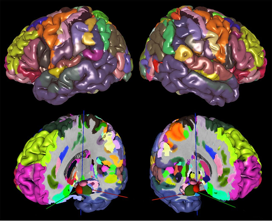 Mapa de parcellação cerebral colorido